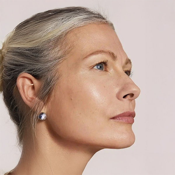 Improves skin tone and complexion