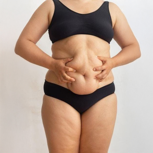 Targeted fat reduction