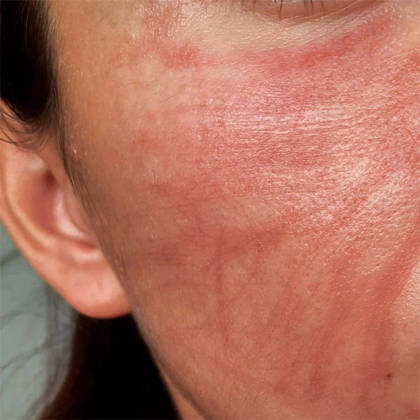 Improves skin texture