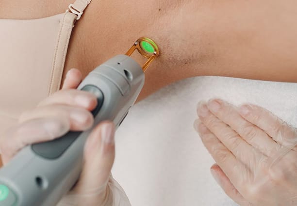 Laser Hair Removal Process 2