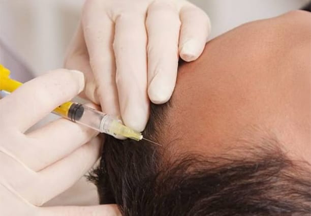 PRP Blood Draw Process