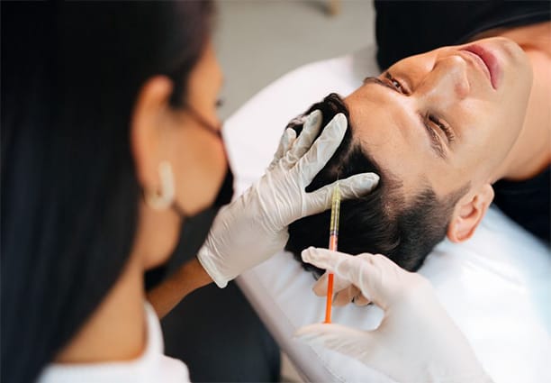 PRP Scalp Injection