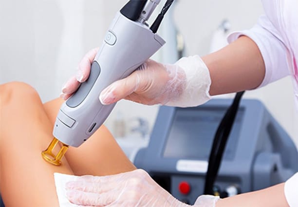 Laser Hair Removal Process 4