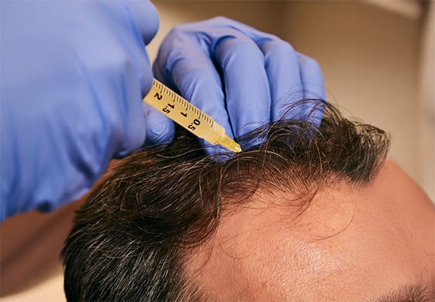 PRP Treatment Doctor