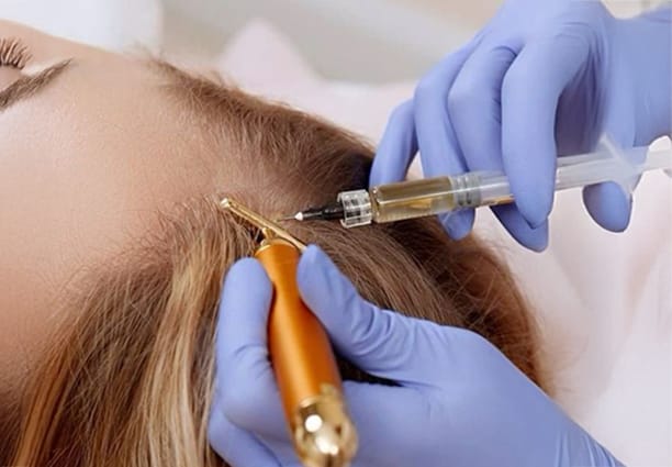 PRP Hair Follicle Stimulation